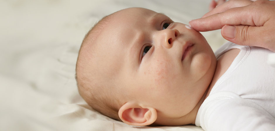Soothing Out Infant Skin Issues