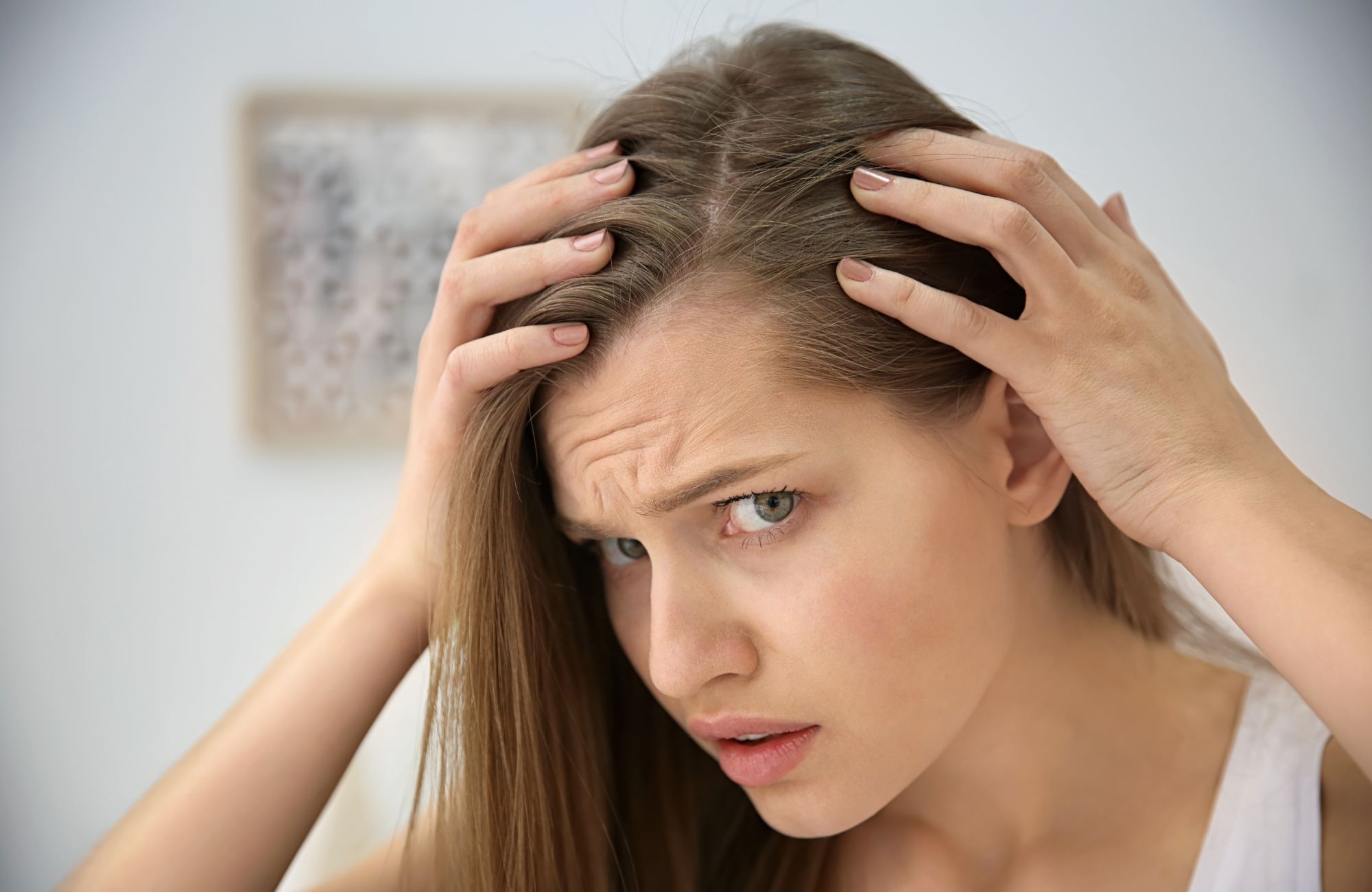Hair Loss in Women: Common Causes and 5 Ways to Treat It